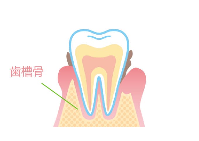 『骨』が溶ける病気