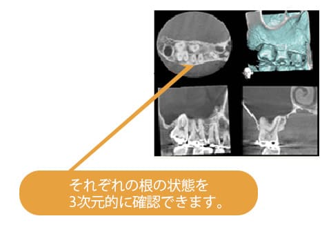 ct画像確認