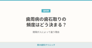 歯周病の歯石取りの頻度はどう決まる？ 間隔が人によって違う理由