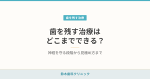 歯を残す治療はどこまでできる？神経を守る段階から見極め方まで